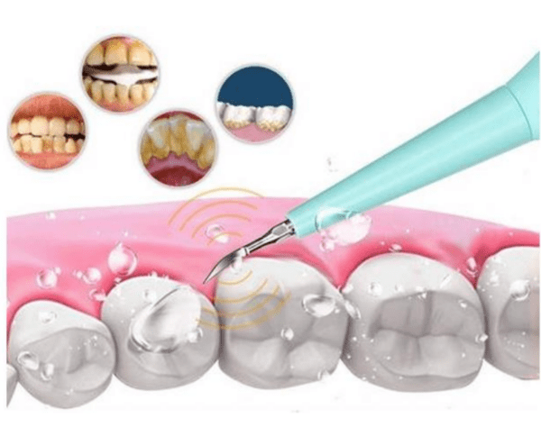 Ултразвуков Уред за Почистване на Зъби, Петна и Зъбен Камък Здраве и Красота waterpik зъбен душ 5